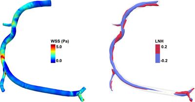Computational fluid dynamics as supporting technology for coronary artery disease diagnosis and treatment: an international survey